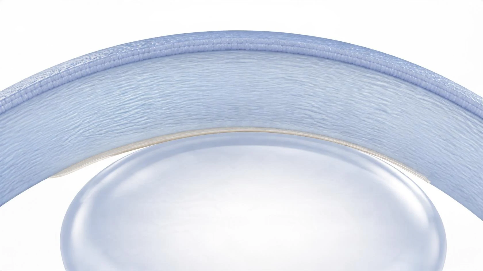 Illustration of the cornea in cross-section: a thin, fully unrolled donor layer lies against the inner surface of the cornea while an air bubble beneath presses it into place